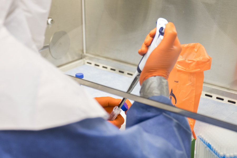 micro pipette in test tube